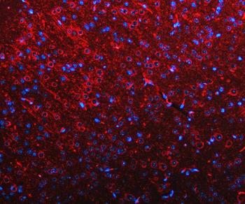 Anti-RIMBP2 Antibody