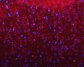 Anti-RIMBP2 Antibody