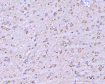 Anti-RIMBP2 Antibody