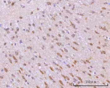 Anti-RIMBP2 Antibody