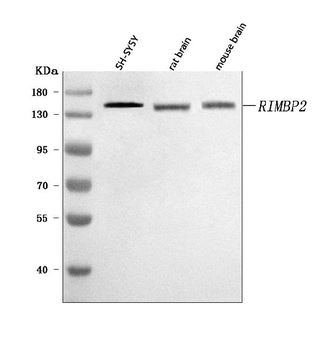 Anti-RIMBP2 Antibody