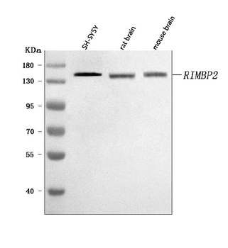 RIMBP2 Antibody