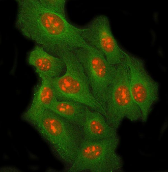 Anti-RRP8 Antibody