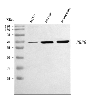 Anti-RRP8 Antibody