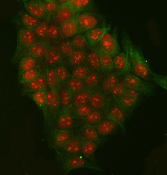 Anti-RRP7A Antibody