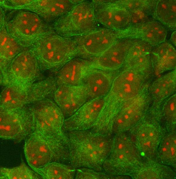 Anti-RRP1B Antibody