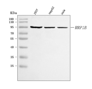 Anti-RRP1B Antibody