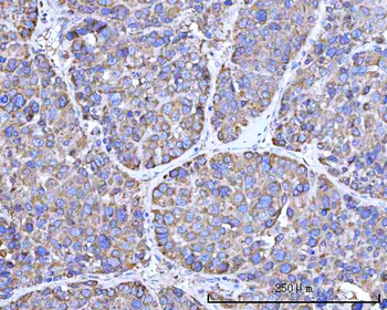 Anti-RPN1 Antibody