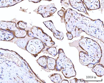 Anti-RPN1 Antibody