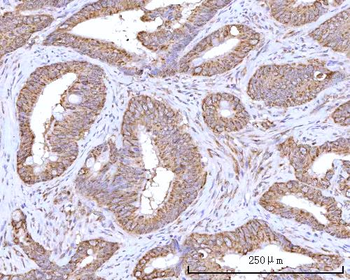 Anti-RPN1 Antibody