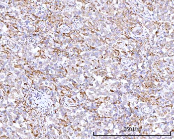 Anti-RPN1 Antibody