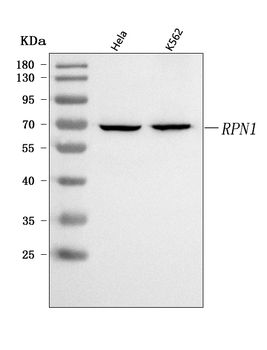 Anti-RPN1 Antibody