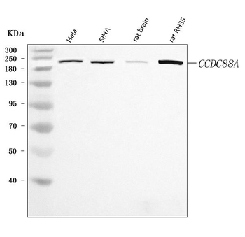 Anti-CCDC88A Antibody
