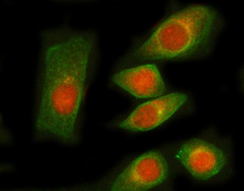 Anti-RNGTT Antibody