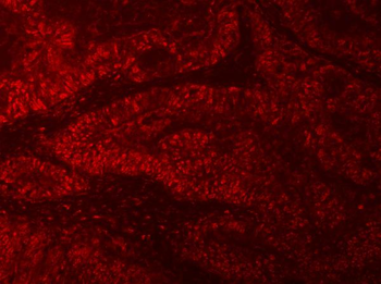 Anti-RNGTT Antibody