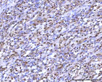 Anti-RNGTT Antibody