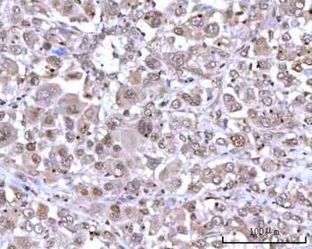 Anti-RNGTT Antibody
