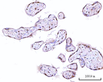 Anti-RNGTT Antibody