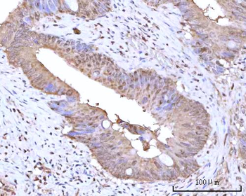 Anti-RNGTT Antibody
