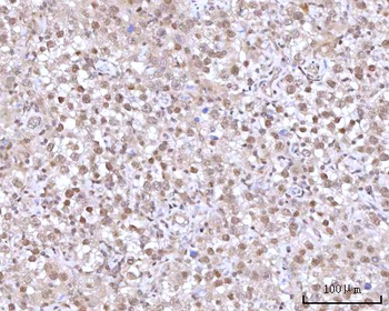 Anti-RNGTT Antibody