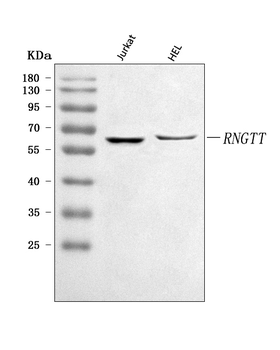 Anti-RNGTT Antibody