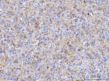 Anti-PTN Antibody
