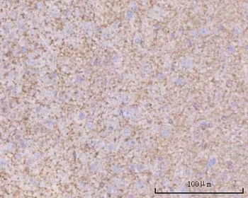 Anti-PTN Antibody