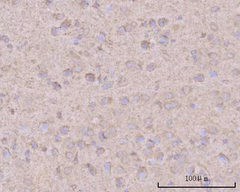 Anti-PTN Antibody