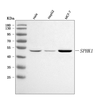 Anti-SPHK1 Antibody