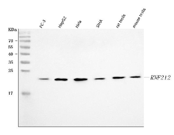 Anti-RNF212 Antibody