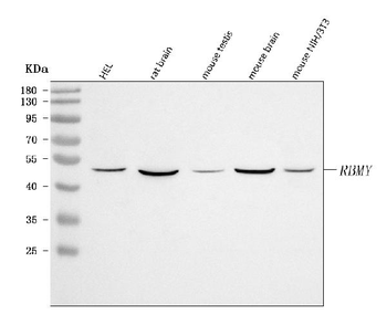Anti-RBMY1A1 Antibody