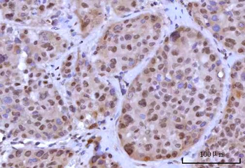 Anti-RNF40 Antibody