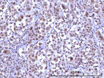 Anti-RNF40 Antibody