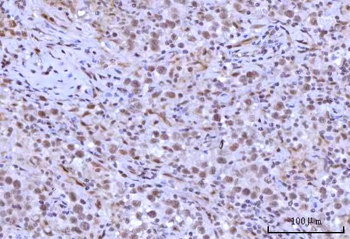 Anti-RNF40 Antibody