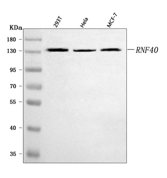 Anti-RNF40 Antibody