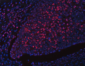 Anti-RFX1 Antibody
