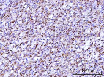 Anti-RFX1 Antibody