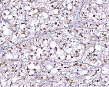 Anti-RFX1 Antibody