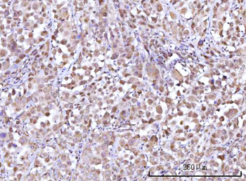 Anti-RFX1 Antibody