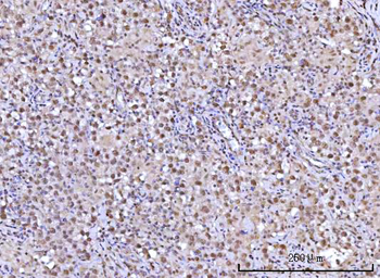 Anti-RFX1 Antibody
