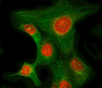 Anti-RIMKLB Antibody