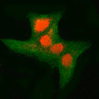 Anti-RNF34 Antibody