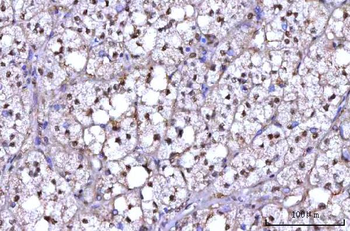 Anti-RNF34 Antibody