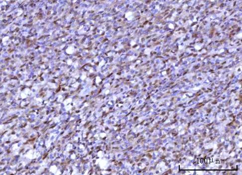 Anti-RNF34 Antibody