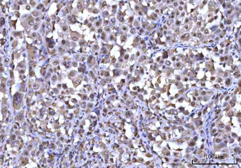 Anti-RNF34 Antibody