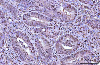 Anti-RNF34 Antibody