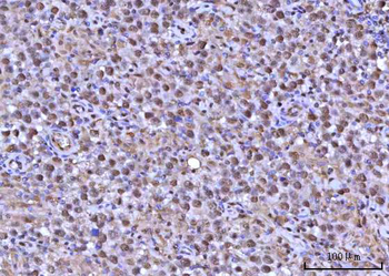 Anti-RNF34 Antibody