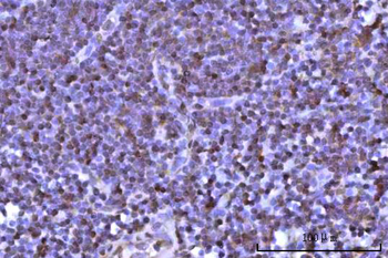 Anti-RNF34 Antibody
