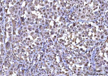 RNF34 Antibody