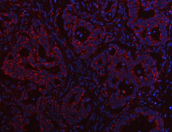 Anti-PTPIP51/RMDN3 Antibody